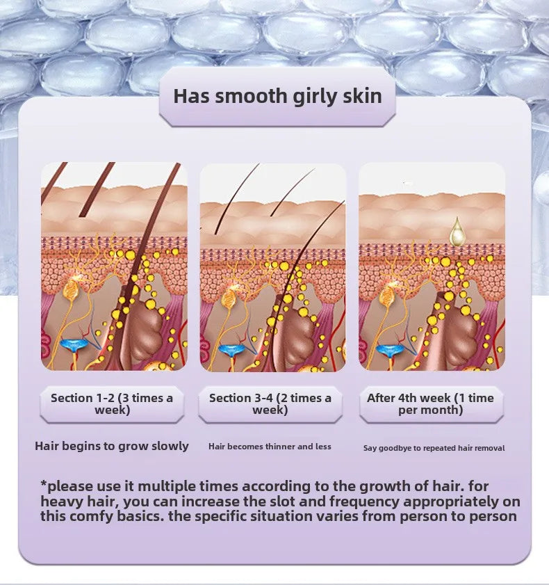 Velluxe IPL Hair Removal Device
